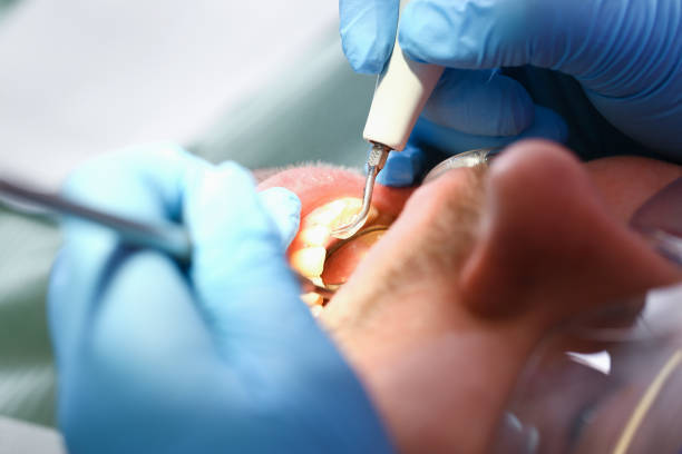 Best Emergency Broken Tooth Repair in Northport, NY